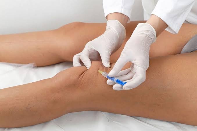 Ácido hialurónico para rodilla