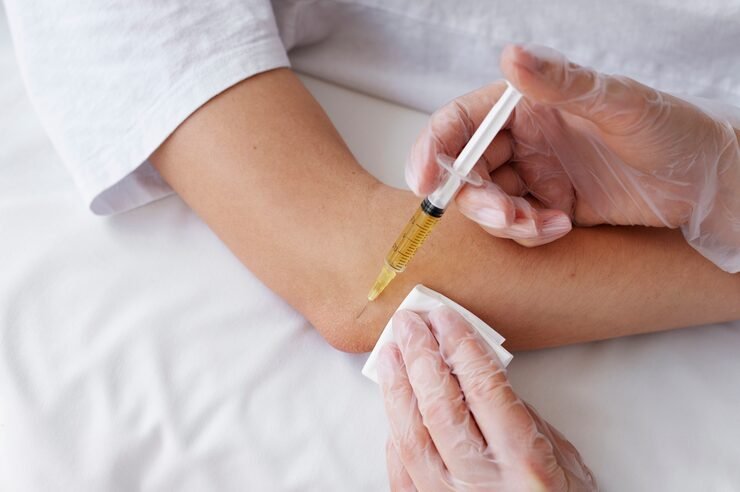 high angle patient getting elbow prp treatment 23 2149404697