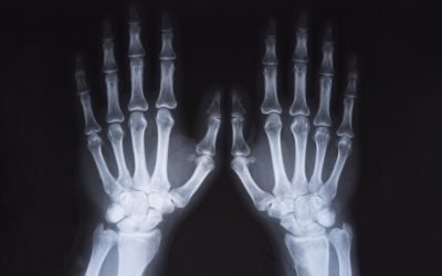 medical-x-ray-hands-image_56854-1792